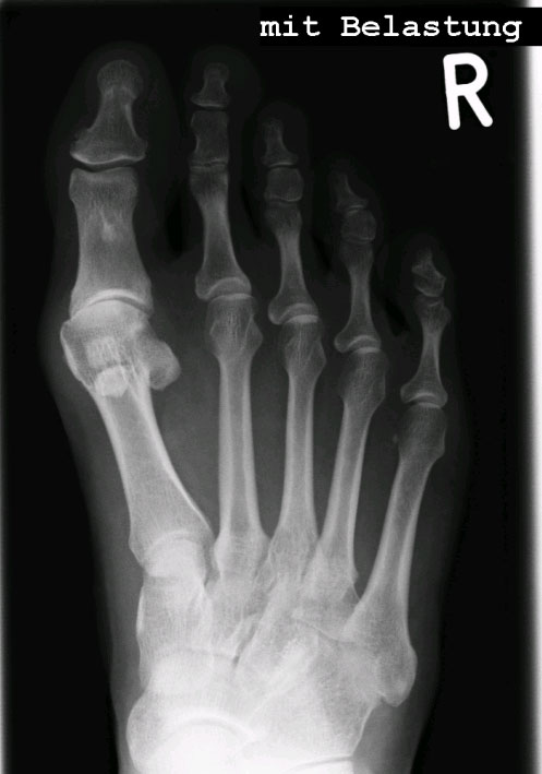 h1